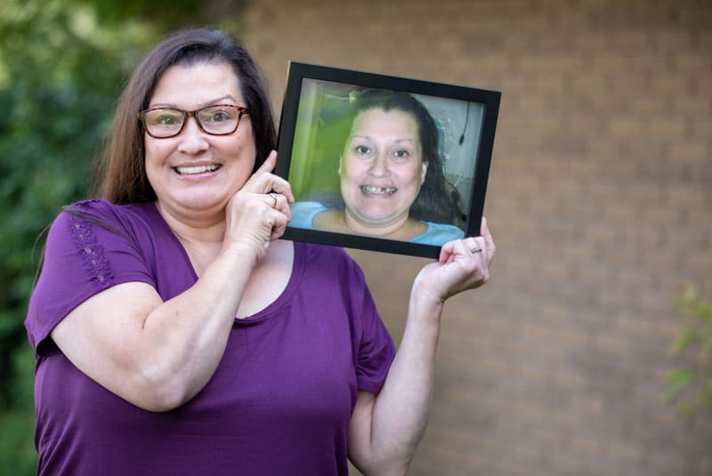 dental implant patient tina smiling with before photos