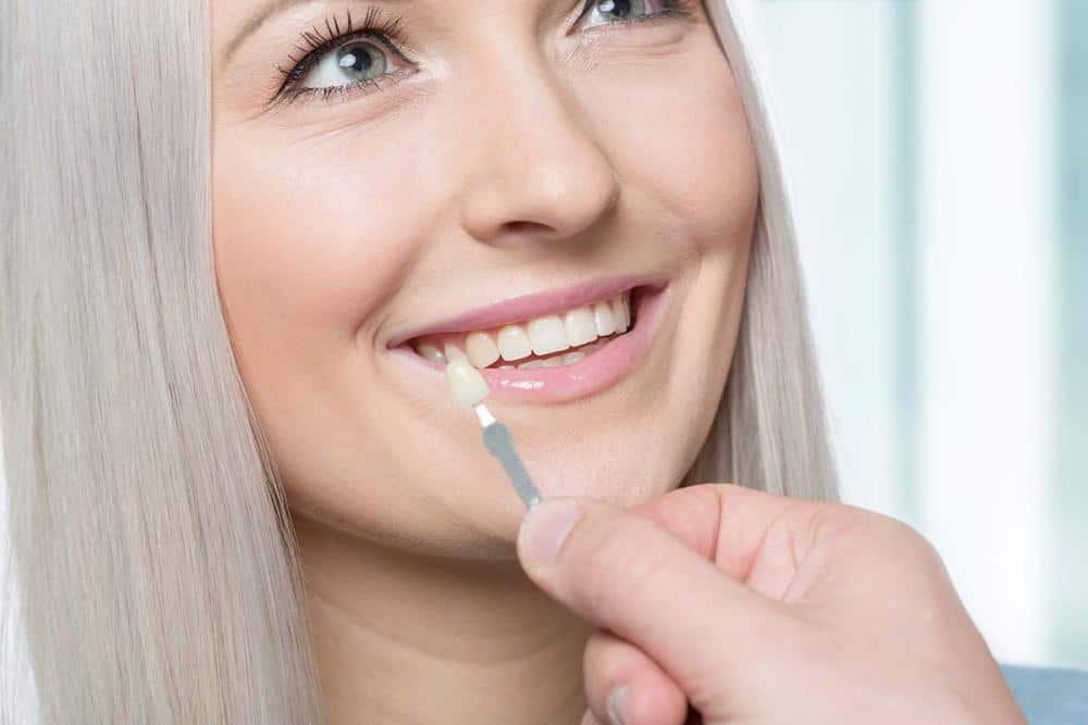 Remedy a Gummy Smile With Veneers