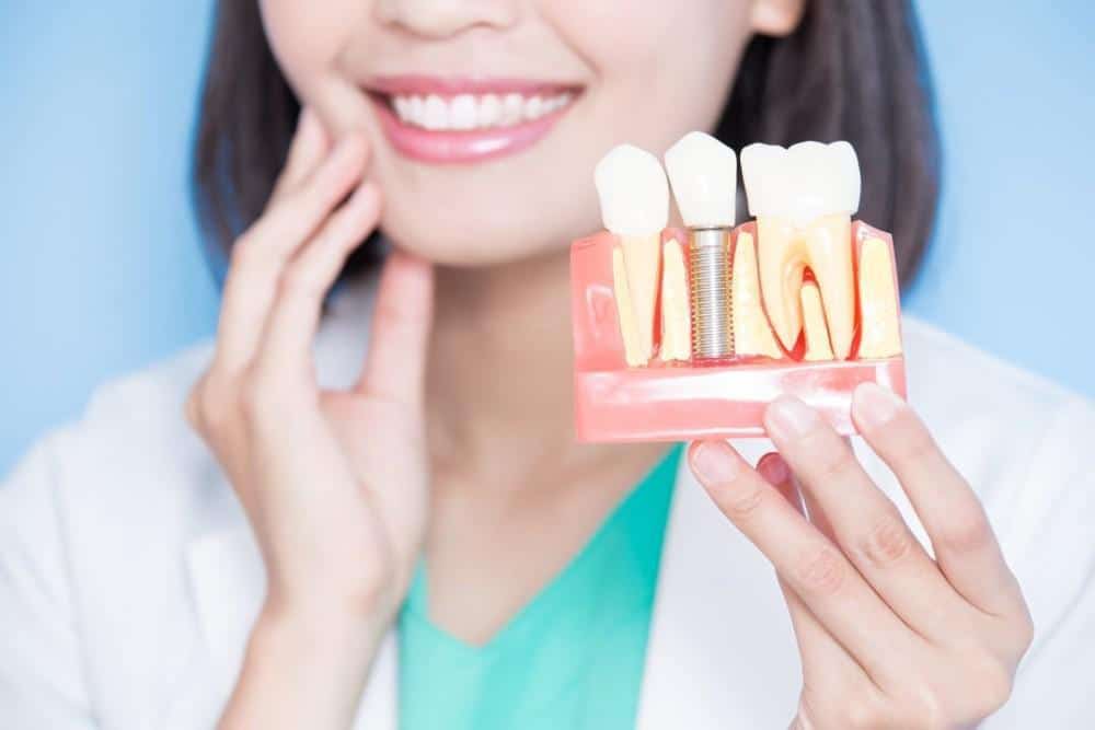 The Dental Implant Process: What to Expect