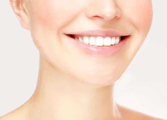 5 Problems That Veneers Resolve