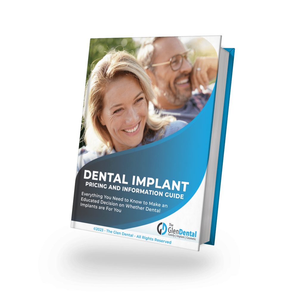 Dental Implant Pricing Guide book